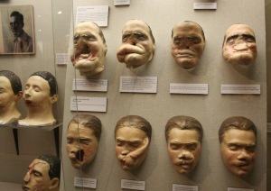 civil war facial injuries